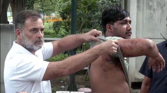 CJP प्रदर्शन में पेलेट गन पर बड़ा खुलासा , पुलिस की डेली डायरी में इस्तेमाल की पुष्टि